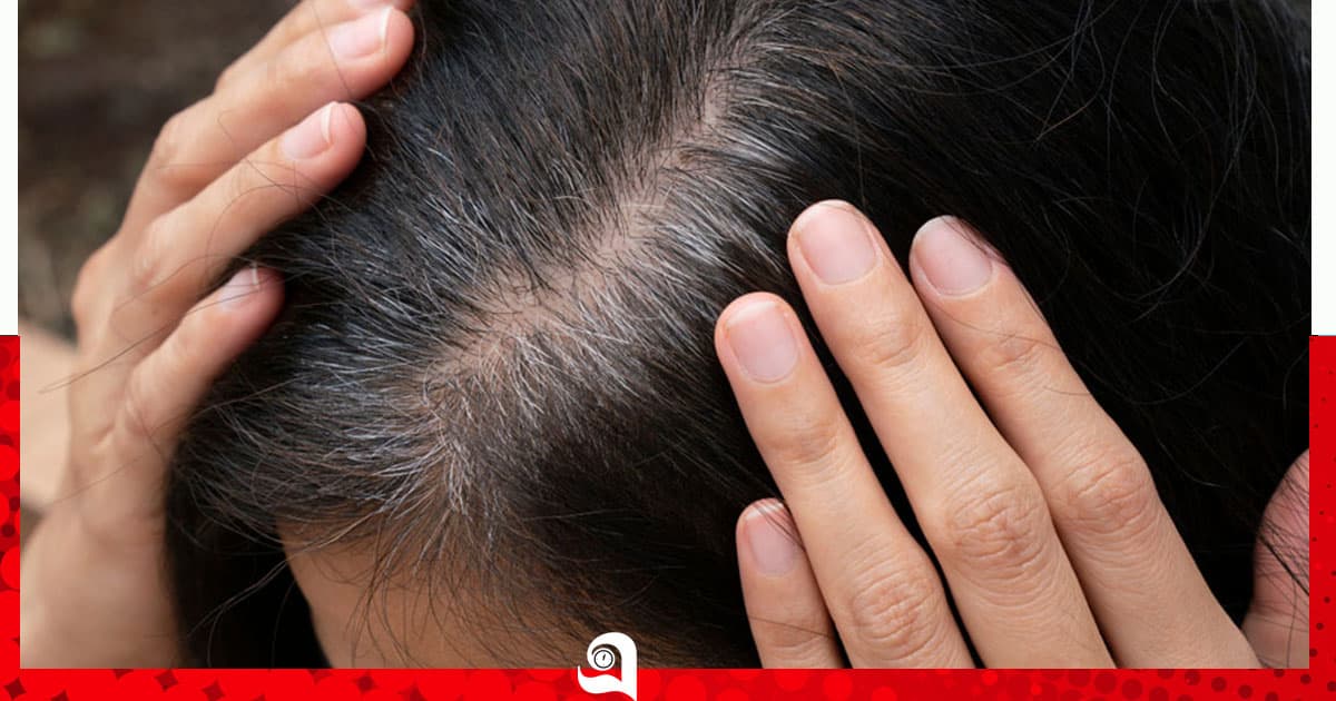 অল্প বয়সেই কেন চুল পেকে যায়?