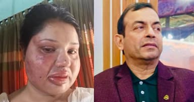 ফিজিওথেরাপির আড়ালে অবৈধ কর্মকাণ্ড, প্রতিবাদ করায় স্ত্রীকে নির্যাতন