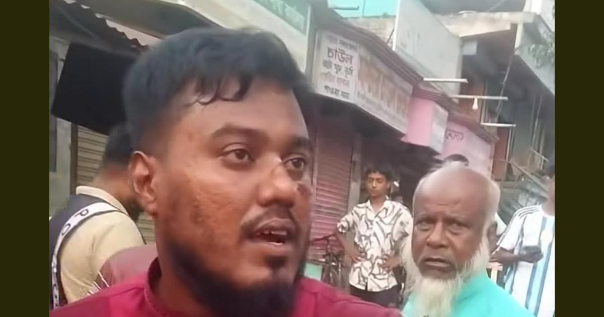 আমির হামজার শ্যালককে মারপিট