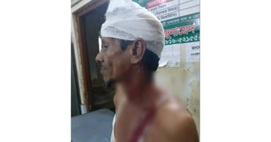 বন প্রহরীকে কুপিয়ে জখম