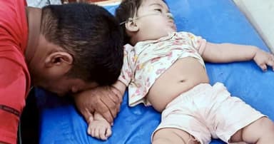 গলায় লিচুর বিচি আটকে ১০ মাস বয়সী শিশুর মৃত্যু