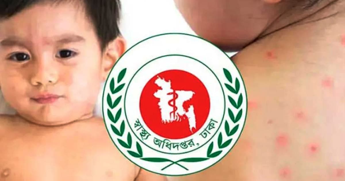 রূপগঞ্জে হামে আক্রান্ত হয়ে ৪ শিশুর মৃত্যু