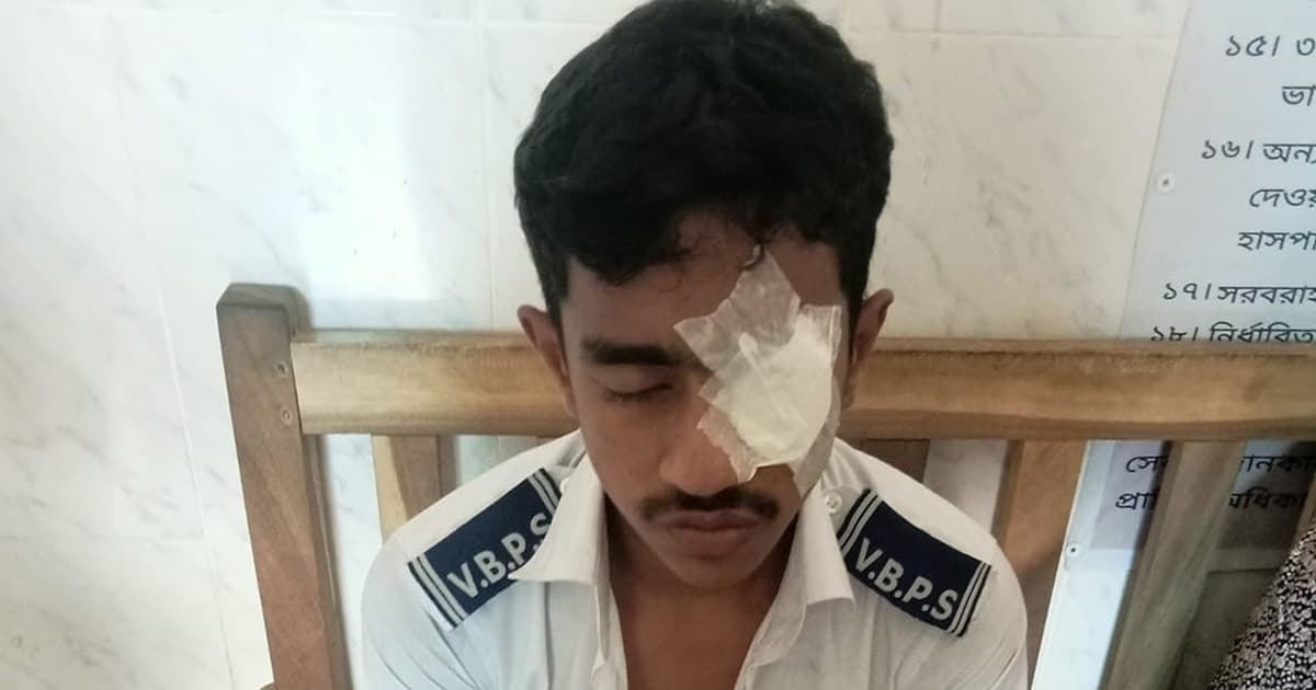 উত্তরপত্র দেখতে না দেওয়ায় সহপাঠীর ঘুষিতে পরীক্ষার্থী হাসপাতালে
