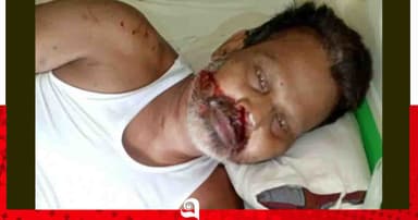 ভালুকায় গ্রাম পুলিশের ক্ষমতা খাটিয়ে মারধর থানায় অভিযোগ